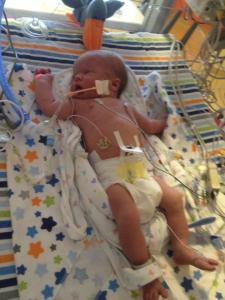 Sawyer Joshua Murphy - 2013-05-10 At Egleston Children's Hospital