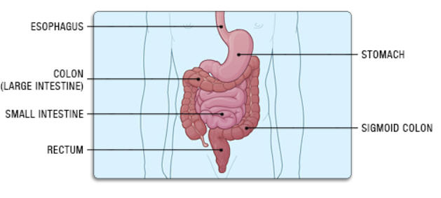 colectomy_body